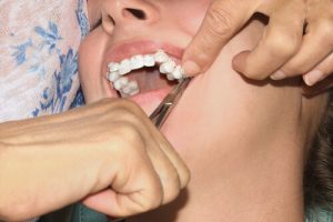 how long do braces hurt after tightening